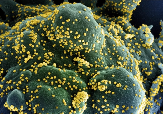 Foto por microscópio eletrônico de varredura mostrando o tecido celular infectado pelo Sars-CoV-2